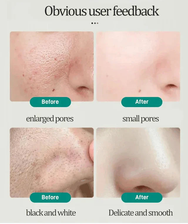 Shanzy Skin Polish (Instant Whitening)